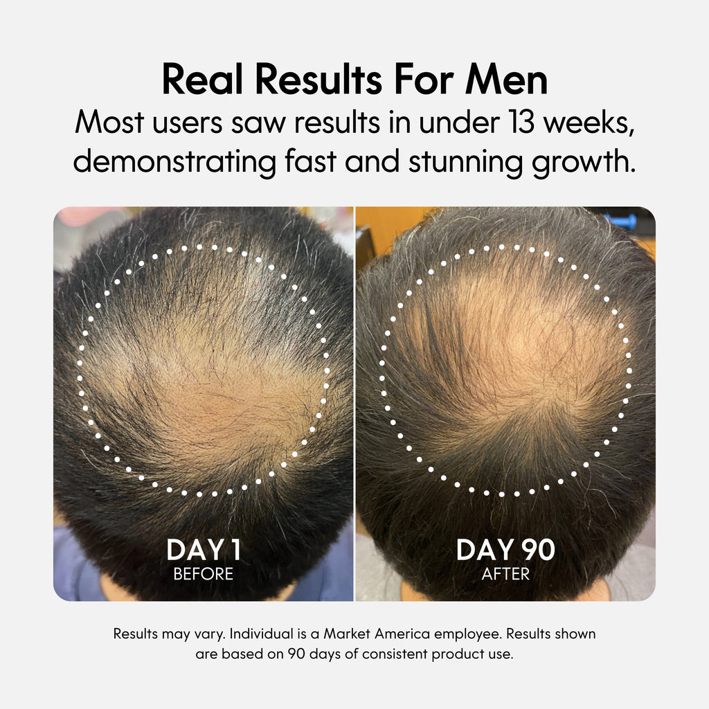 Fixx Hair Growth