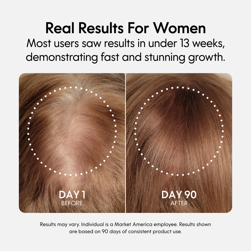 Fixx Hair Growth