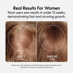 Fixx Hair Growth