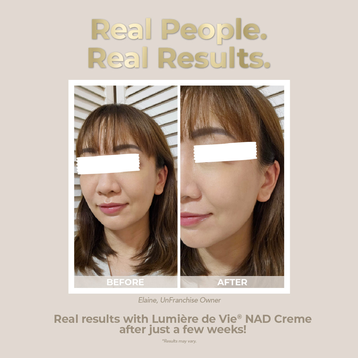 LDV_NAD_ALT2 - media