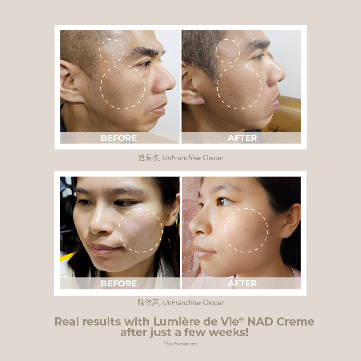 LDV_NAD_ALT1 - media